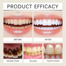 100克羟基磷灰石美白牙膏 - 温和去除牙渍，提亮牙齿，护釉配方，持久薄荷清新，让您拥有自信笑容 - 彩色 - 查看 4