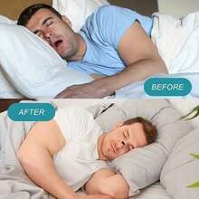 560/300/200/90PCS  Dilator And Nose Strips Set With  Patches,  Strips,  Clips,  Tapes, Nose Dilator, Nose Patches, Nose Clips, And Nose Tapes - Innovative Technology To Reduce Snoring By 90% And Support Uninterrupted Sleep For Daily Energy. Ideal For Various Occasions Like Travel, Camping, Sports, And Home Use. Seasonal Promotion For Back To School And Halloween, Featuring A Sweatproof And Comfortable Build That Reduces Snoring And Improves Sleep. Reusable And Portable. Order Now For A Better Sleep Experience! - tròn - Xem 9