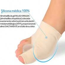 1 par de correctores ortopédicos de hallux valgus, separadores de dedos, corrección de valgo. - Albaricoque - Ver 7