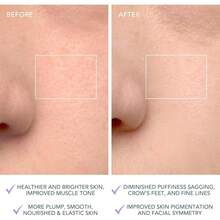 PZW-FOREO LUNA 4 Face Cleansing Brush Firming Face Massager Anti Aging Face Care Enhances Absorption of Facial Skin Care Products Simple Skin Care Tools Sensitive Skin8766 - Piel sensible - Ver 6