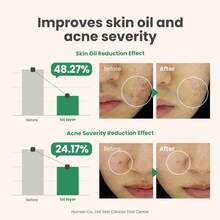 AXIS-Y Spot The Difference Blemish Spot Treatment -  0.50 Fl. Oz. - Màu Hồng baby - Xem 5