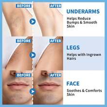 3-Piece Set,Razor Bump Stopper Roll-On, Dark Spot Remover & Ingrown Hair Treatment For Men & Women, No Bump After Shave Serum For Bikini, Face, Neck, Underarms & Legs-Valentines Gifts,Birthday,Gifts For Women,Mardi Gras - 淺藍色 - 查看 4