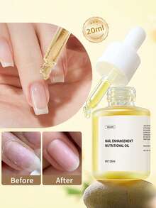 XEIJAYI 20毫升指甲营养角质层护理油，植物滋养油，指甲调理保湿，角质层护理，指甲护理工具 - 黃色 - 查看 2