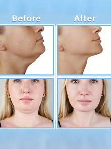 20pcs Invisible Neck Lift Patches, Neck Lift Tape, Face And Neck Lifting Tape, Easy To Wear, Flexible Fit, Waterproof, Neck Support Tape, Suitable For Daily Wear, Essential For Beauty Enthusiasts - Multicolor - View 3