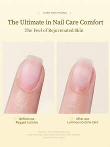 XEIJAYI 20毫升指甲营养角质层护理油，植物滋养油，指甲调理保湿，角质层护理，指甲护理工具 - 黃色 - 查看 9