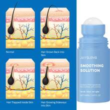 3-Piece Set,Razor Bump Stopper Roll-On, Dark Spot Remover & Ingrown Hair Treatment For Men & Women, No Bump After Shave Serum For Bikini, Face, Neck, Underarms & Legs-Valentines Gifts,Birthday,Gifts For Women,Mardi Gras - 淺藍色 - 查看 5