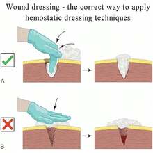 Kit de Entrenamiento para Detener hemorragias 4 Tipos Modelos para el Cuidado de heridas simulación de hemorragias Ejercicios de Control de la Sangre Modelo de sutura para formación A