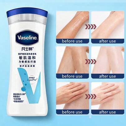 Vaseline Sensitive Care Body Lotion, Gentle Moisturizing, Suitable For Sensitive Skin