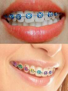 40/10pcs Multi-Color Elastic Orthodontic Rubber Bands Set - Soft High Elasticity Braces Bands | Easy Care Oral Hygiene Kit - Multicolor - View 3