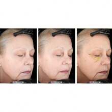 Vita A 视黄醇紧致精华液 | 0.1% 视黄醇，3% Matrixyl，高浓度视黄醇，抗衰老，收缩毛孔，减少细纹和皱纹，紧致肌肤，15毫升 - 彩色 - 查看 10