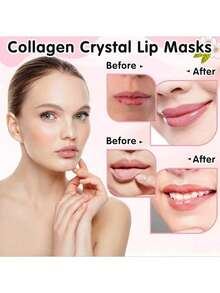 1/3/5/10pcs Eye & Lip Gel Ice Pack | Reusable Hot/Cold Compress, Reduce Dark Circles, Smooth Fine Lines, Soothe Eye Muscles, Suitable For All Skin Types, Unisex, Thoughtful Care Gift - Multicolor - View 5