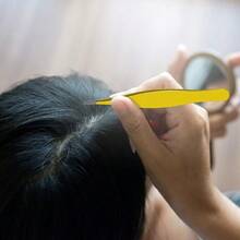 Honoson 1pc Tweezers, For Removing Ingrown Hair, Blackheads, Nose Hair, Facial Hair, Eyebrows And Debris (Yellow) - Yellow - View 7