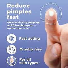360pcs+12/720/108pcs Acne Pimple Patch, Hydrocolloid Material, Alcohol-Free, Gentle & Non-Irritating, Invisible & Ultra-Thin, Suitable For All Skin Types