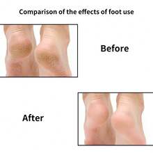 Nasin 60片可替换砂纸片，带金属圆盘、粉色指甲锉和抛光块，足部护理工具配件