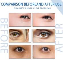 Hoygi 眼部亮白精华液 - 减少眼袋和黑眼圈，淡化细纹，保湿紧致肌肤，令眼周肌肤焕发活力，年轻光彩。 - 彩色 - 查看 4