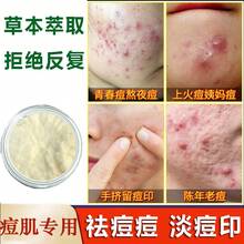 Crema Herbal para el Acné Tratamiento Purificante del Acné Reparación de Cicatrices de Acné Crema para Cicatrices de Acné Crema - Crema potente para el acné 1000 g - Ver 1