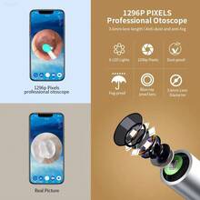 Ear Wax Removal - Earwax Remover Tool With 8 Pcs Ear Set - Ear Cleaner With Camera - Ear Camera With 6 Ear Spoon Replacement- Ear Cleaner For IOS & Android - Black - View 3