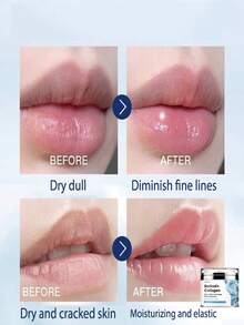 5%玻尿酸保湿霜，日夜保湿 - 彩色 - 查看 11