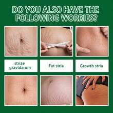 1pc 30ml Skin Care Spray Postpartum Abdominal Skin Moisturizing Massage Care Spray - 30ml - View 7