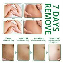1pc 30ml Skin Care Spray Postpartum Abdominal Skin Moisturizing Massage Care Spray - 30ml - View 8