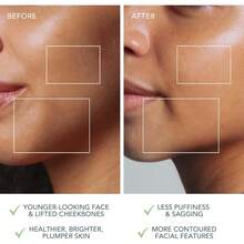 FOREO BEAR 2 go - Tonificador facial de microcorrientes para llevar de viaje - Masajeador facial antiarrugas - Lifting facial inmediato - Reafirma y define - Skincare compacto - Pistachio - Pistacho - Ver 5