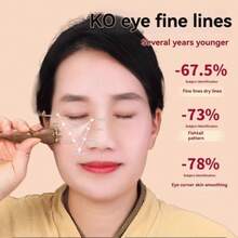 3-In-1 Rose Massage Tool For Feet, Scalp And Body, 5-Point Pressure Relief For Face/Eyes/Nose/Ears/Hands, Portable Gua Sha Shaping Massager, Acupressure Skincare Tool, Suitable For Body SPA, Travel And Office Self-Care, Perfect Gift For Women - Multicolor - View 3