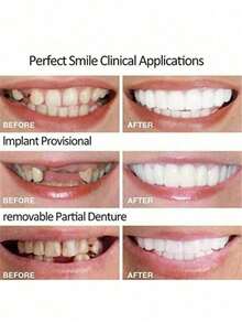 4/5片舒适贴合的美齿贴面：上下牙均可使用，重塑您自信迷人的笑容 - 彩色 - 查看 7