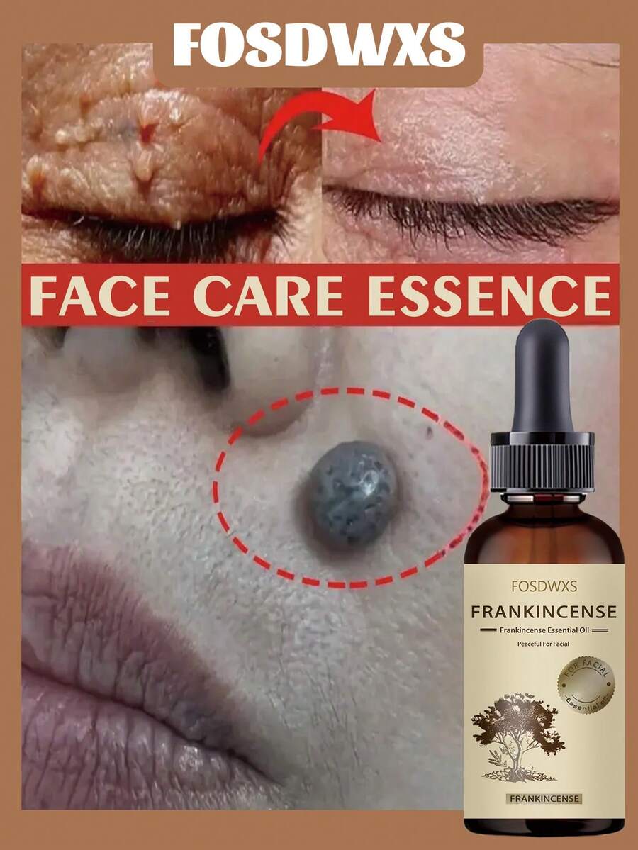 乳香精油，“舒缓面部肌肤”镇静滋养 - 彩色 - 查看 1