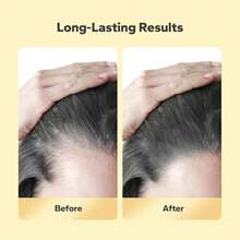 2pcs Hair Regrowth Powder Stick, Instantly Cover Roots (Black), Waterproof Root Concealer, Suitable For Sparse Roots, Long-Lasting Quick Coverage, Unisex Hair Powder Stick - Black - View 4