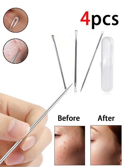 4pcs Box Set Of Stainless Steel Acne Needles, Professional Blackhead Extractors, Ergonomic Handles, Suitable For Squeezing Whiteheads And Blackheads, Acne Removal And Facial Cleansing, No Battery Required, Portable Design, Durable Material, Easy To Clean, Essential For Beauty Enthusiasts, Specially Designed For Skin Care, Beauty Tools, Facial Cleansing Tools
