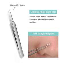 1 Blackhead Tweezers, Slanted Pimple Tweezers, Cell Tweezers, Beauty Tools, Acne Tweezers, Stainless Steel Pimple Tweezers