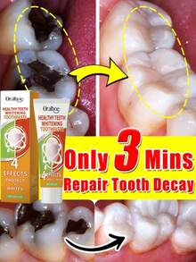 Termina con los problemas de caries y restaura una sonrisa confiada - 1 artículo - Ver 1