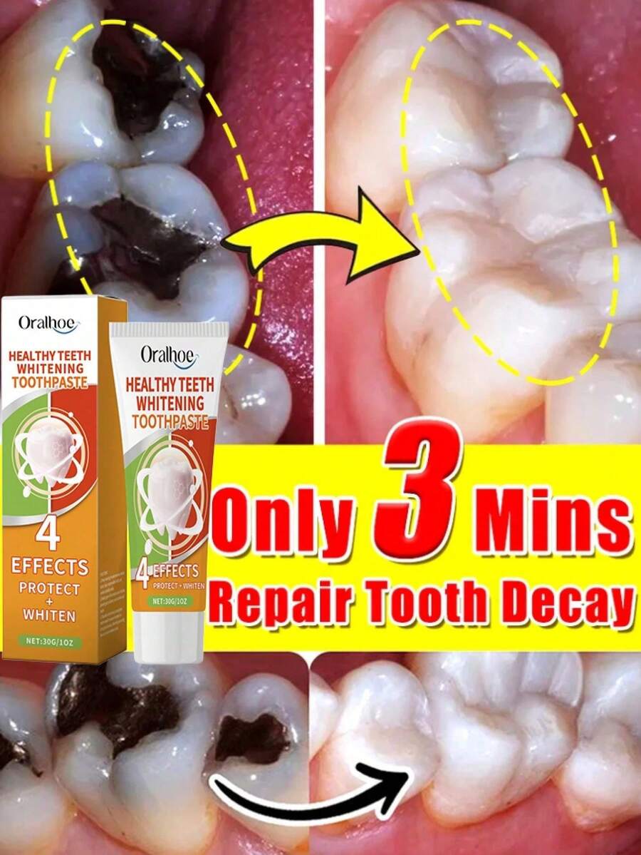 Termina con los problemas de caries y restaura una sonrisa confiada - 1 artículo - Ver 1