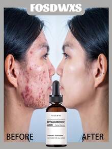 Hyaluronic Acid Facial Serum | Deep Hydration And Moisture Lock, Suitable For All Skin Types, Nourishing And Radiant Complexion - Multicolor - View 9