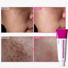 Arbutin 7% + Tranexamic Acid 4% Brightening Cream, 70,000ppm Arbutin & 40,000ppm TXA With Niacinamide & Glutathione, Dark Spot Corrector For Face, Freckles & Pigmentation, Korean Skin Care, 50ml, Perfect Gift For Women - AC-A - 查看 4