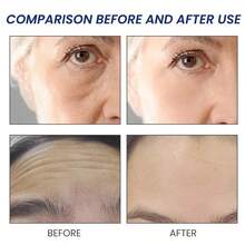 Niacinamide Anti-Aging Facial Serum (Serum), 2-Bottle Pack, Targets Fine Lines And Wrinkles, Firms Skin, Deeply Moisturizes, Promotes Collagen And Elastin Production. Prevents Skin Aging, Prevents Facial Muscle Contraction, Suitable For All Skin Types. - 2-bottle - 查看 6