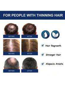 Having Thick Hair Volume - 1PCS - View 4