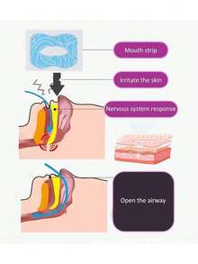 Estilo30 Tiras De RespiracióN Para NiñOs, Cinta Para Dormir En La Boca, Tiras Para Dormir En La Boca, Ayuda Para Dormir En La Boca Para La RespiracióN , ReduccióN De La RespiracióN Bucal AzulVersióN Mejorada - 1 - Ver 6