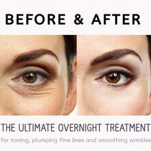 3 Pairs Of Equipment Eye Patch, Micro Needle Hyaluronic Acid Soluble Dissolving Microneedle Under Eye Patch, 3 Types Of Packaging, - Multicolor - View 9