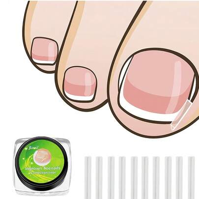 10 piezas de parches elásticos correctores de uñas encarnadas sin dolor, herramientas de cuidado de uñas, parches correctores de uñas, adecuados para hombres y mujeres, un lindo regalo pequeño para entusiastas del cuidado de los pies