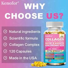 14 IN 1 Collagen 120 Softgels - With Biotin, Keratin, And Hyaluronic Acid - Supports Skin, Nail, And Hair Health And Joint Health - 1 chai - Xem 9