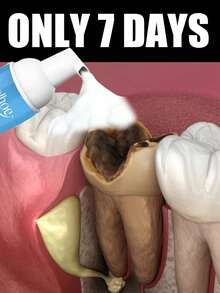 Oral Whitening Foam Toothpaste - Clean Teeth, Whiten & Freshen Breath, Dental Care Foam For Oral Hygiene Enhancement - 1 Item - View 1