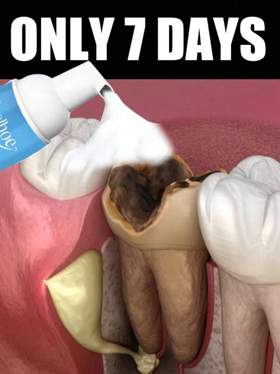 Oral Whitening Foam Toothpaste - Clean Teeth, Whiten & Freshen Breath, Dental Care Foam For Oral Hygiene Enhancement - 1 Item - View 1