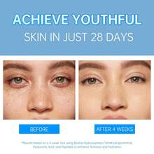 Pro-Xylane 丰盈紧致保湿霜 - 日常面部保湿霜，适合所有肤质，蕴含透明质酸钠、维生素E、生物素和乳木果油，滋养保湿；Pro-Xylane 亮白霜，修复受损肌肤，紧致肌肤，50克