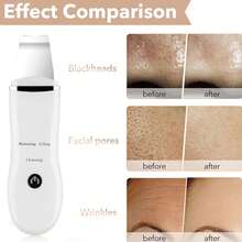 Face Scrubber & Pore Cleaner Tool, Rechargeable Blackhead Remover With 3 Modes, Waterproof Silicone Skincare Spatula For Deep Cleansing & Exfoliating, All Skin Types, White - Ideal Daily Skincare & Holiday Gift For Women - 白色 - 查看 4