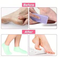 硅胶保湿足套和手套套装 - 凝胶保湿袜、保湿手套，专为女性足部护理设计，适用于干燥、粗糙的足部，女性足部护理工具套装 - 彩色 - 查看 5