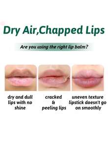 Mentholatum 曼秀雷敦修护保湿润唇膏+唇胶，8克唇胶+3.5克润唇膏，SPF15经典薄荷味，修护、深层补水、软化角质层、淡化细纹、抗氧化保护、即刻提亮、持久滋养、保湿、柔滑妆前乳，适合通勤、圣诞礼物、冬季急救、全年多效润唇膏 - 8g潤唇啫咖哩+3.5g唇膏(薄荷) - 查看 3