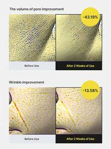 celimax 30ml/1.01 Fl Oz Vitamin A Retinol Firming Serum | Formulated With Pure Vitamin A Retinol, Peptides, Pore Tightening, Wrinkle & Fine Line Reduction, Skin Firming, Anti-Aging, Smooth Skin, Korean Cosmetics - 30ml - View 7