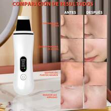 TendenciaLimpieza Profunda Facial Ultrasónica Portátil ProfesionalCalidad premium - Blanco - Ver 5