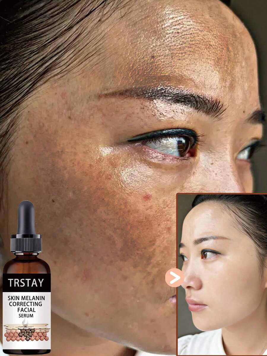 温和面部精华液，轻柔稳定肌肤状态，净化并改善肌肤纹理。 - 彩色 - 查看 1